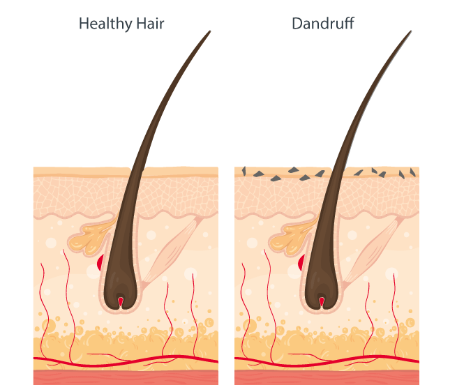 Itchy scalp – Overview about potential causes