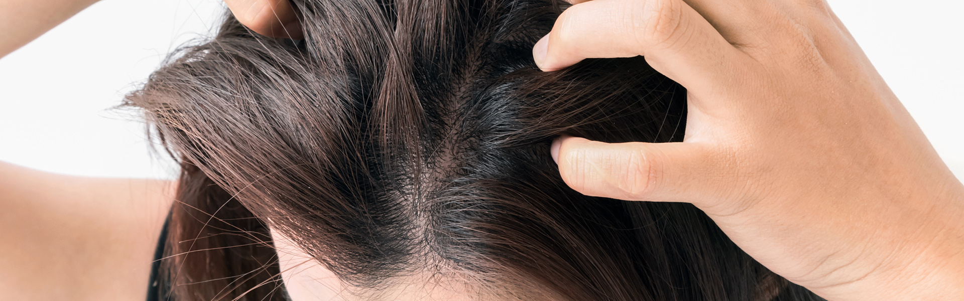 Itchy scalp – Overview about potential causes