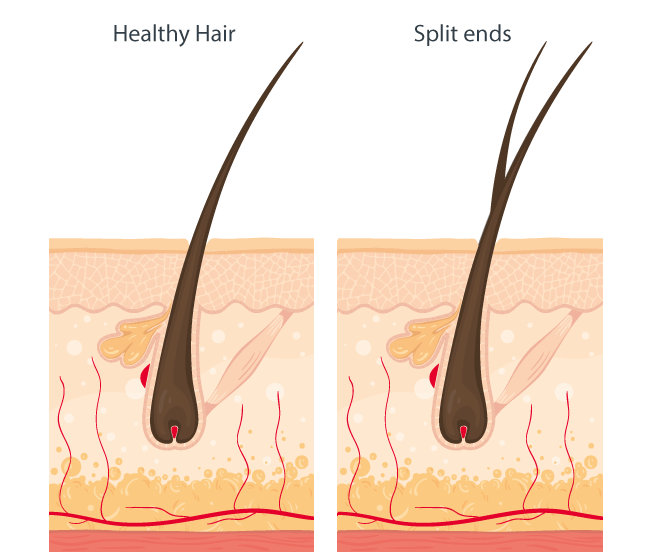 Image of Split ends showing natural hair problem