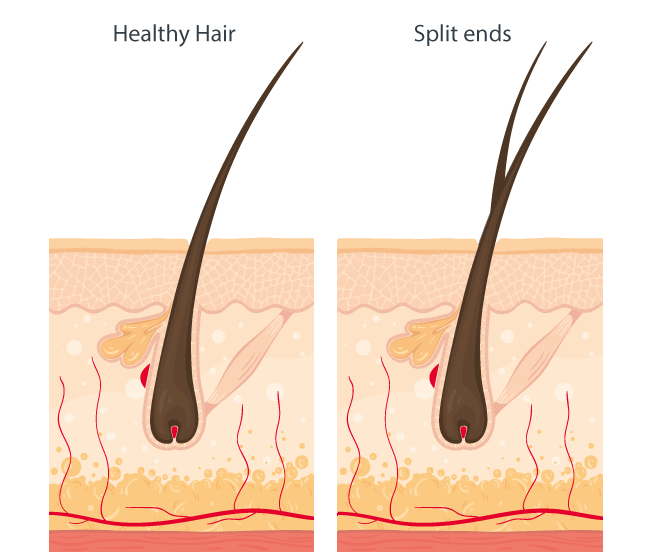 Split ends – Overview about damaged hair